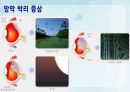 성인간호학(안과질환,은하출판사) 27페이지