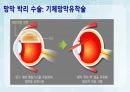성인간호학(안과질환,은하출판사) 31페이지