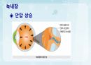 성인간호학(안과질환,은하출판사) 36페이지