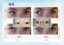 성인간호학(안과질환,은하출판사) 50페이지