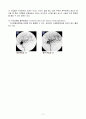 Moyamoya, Cerebral infarction (모야모야병, 뇌경색) 13페이지