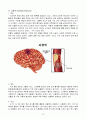 Moyamoya, Cerebral infarction (모야모야병, 뇌경색) 14페이지