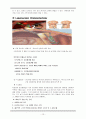 Acute cholecystitis Case study (이미지 포함), 간호진단,과정 각각 2개씩 10페이지