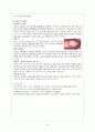A+받은 Liver Cirrhosis 간경변 케이스 스터디 간호과정  2개 6페이지