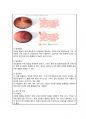 성인간호학실습 A+/ 게실염 CASESTUDY(간호과정)/간호진단3개, 간호과정3개 5페이지