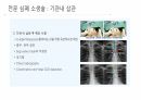 응급 간호 및 CPR 60페이지