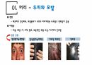 건강사정 - 머리, 얼굴 림프 PPT자료 A+ 4페이지