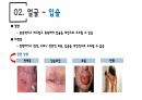 건강사정 - 머리, 얼굴 림프 PPT자료 A+ 8페이지