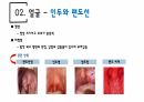 건강사정 - 머리, 얼굴 림프 PPT자료 A+ 13페이지