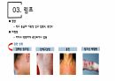 건강사정 - 머리, 얼굴 림프 PPT자료 A+ 14페이지