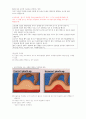 당뇨병 약물요법 보고서 8페이지