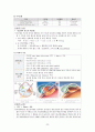 성인간호학_Case study_Vitreous hemorrhage 32페이지
