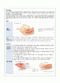 [A+]모성간호-자궁내막암관련(정의,검사방법,진단,치료,예방등) 4페이지
