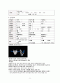 성인간호학실습 케이스스터디 췌장암(pancreatic cancer) A+ 받은 사례보고서 입니다. 9페이지