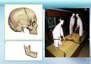 세미나자료 치과보철학 임플란트 시스템에 대해서 알아보자(치의학, 치기공, 치위생) 16페이지