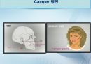 세미나자료 치과보철학 임플란트 시스템에 대해서 알아보자(치의학, 치기공, 치위생) 18페이지