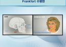 세미나자료 치과보철학 임플란트 시스템에 대해서 알아보자(치의학, 치기공, 치위생) 19페이지