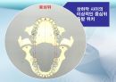 세미나자료 치과보철학 임플란트 시스템에 대해서 알아보자(치의학, 치기공, 치위생) 26페이지