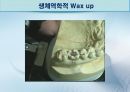 세미나자료 치과보철학 임플란트 시스템에 대해서 알아보자(치의학, 치기공, 치위생) 40페이지