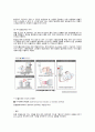 DLBCL 미만성 거대 B세포 림프종 케이스 스터디, 혈액암 환자 케이스 스터디, 암환자 케이스 문헌고찰 간호진단 간호과정 7페이지