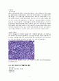 [간호학과 실습 케이스] 암병동 `비호지킨림프종(non-Hodgkin`s lymphoma)` 케이스 간호진단 및 간호과정 3개 A+ 받은 자료입니다. 9페이지