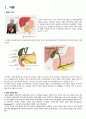 성인간호A+ 담석증 case study 4페이지