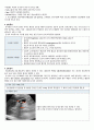 성인간호A+ 담석증 case study 5페이지