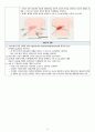성인간호A+ 담석증 case study 8페이지