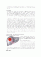 간암 케이스스터디 [간암 Case study] 10페이지