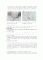 간암 케이스스터디 [간암 Case study] 11페이지