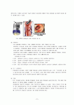 간경화 케이스 5페이지