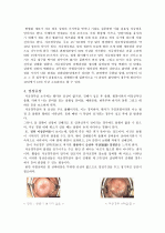 cervical dysplasia(자궁경부이형성증) 케이스 18페이지