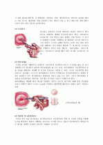 cervical dysplasia(자궁경부이형성증) 케이스 20페이지