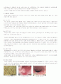 대장암 (colorectal cancer) 내용 정리 2페이지