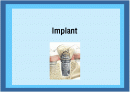 Implant(임플란트)에 대해 1페이지