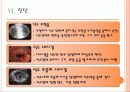 식도암(Esophageal cancer) 10페이지
