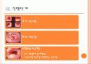 식도암(Esophageal cancer) 13페이지