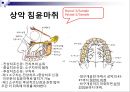 발치 4페이지