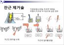 발치 15페이지