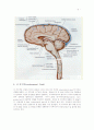 뇌수종(Hydrocephalus)과 V-P shunt 수술 5페이지