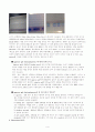 실험 10. Plasmid 분리 실험 & Agarose gel을 이용한 plasmid 전기영동 : 실험결과 4페이지