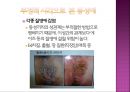 한국 동성애자 문제 - 긍정적인 시각, 부정적인 시각 및 인식 분석.pptx 14페이지