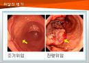 위암 10페이지