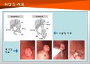 위암 14페이지