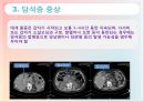담석증의 식사요법, 증상, 진단, 담석증 케이스 스터디 Case Study.ppt 6페이지