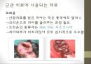 근관치료 장비 및 재료 & 니켈티타늄 전동파일의 파절과 임상적 예후.pptx 11페이지