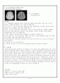NS케이스-Brain Tumor (두개내종양) A++ 14페이지