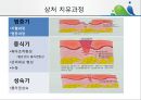 [상처관리-욕창, 수] 상처관리-욕창,  수술창상,  화상 13페이지