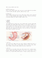 [수술실 실습] stomach cancer(위암) 케이스 5페이지