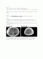 신규간호사도 이해할 수 있게 만든 뇌내출혈 및 두개내압 공부 10페이지